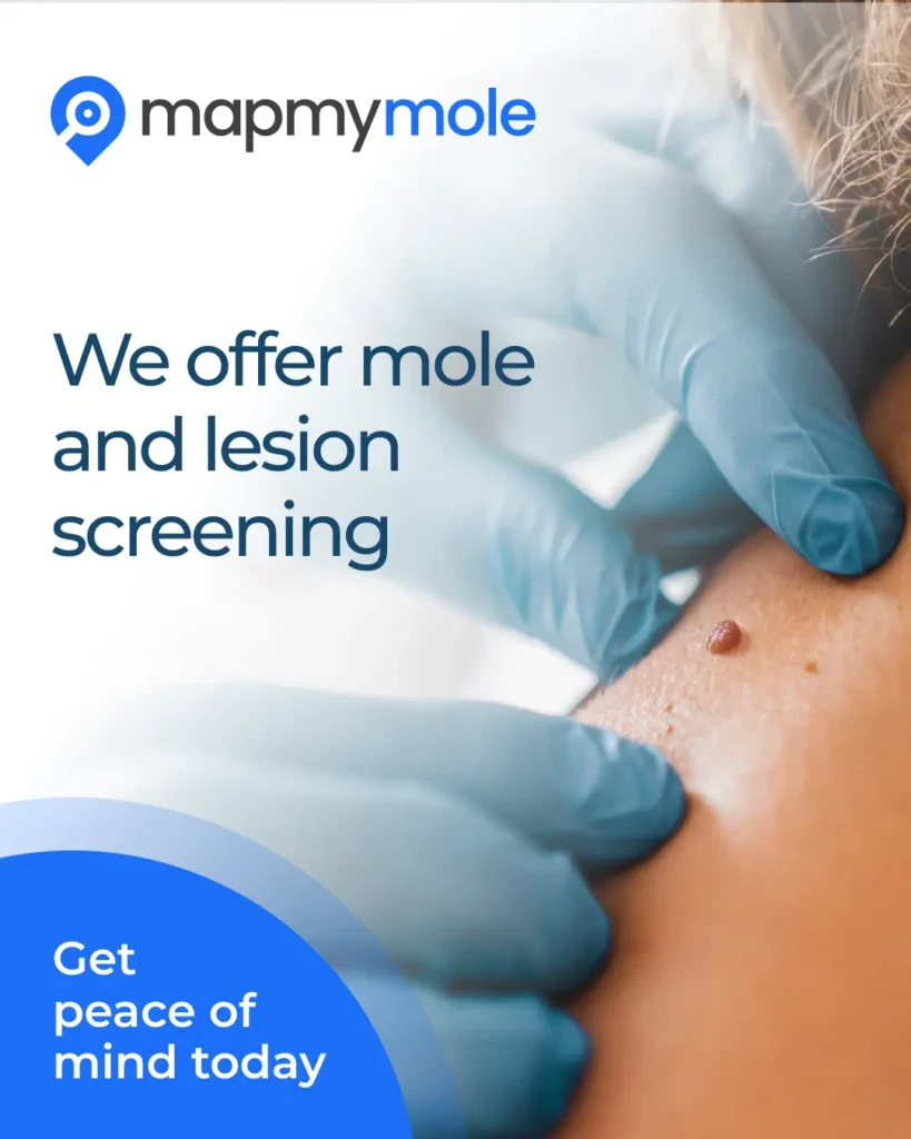Map My Mole: mole and skin lesion screening, showing gloved hands around a mole on a shoulder.
